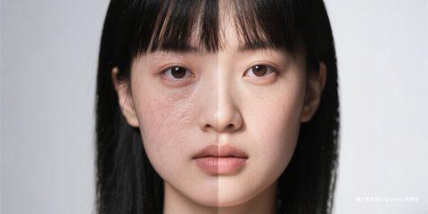 在皮肤科临床中，「油水平衡」与「肌肤屏障」始终是两个密不可分的核心概念。
许多肌肤问题，如干燥、敏感、出油、粉刺与泛红，往往都与这两者失调有关。
从医师的角度来看，想要维持皮肤健康，必须同时注重油水平衡的调整与屏障功能的修护。